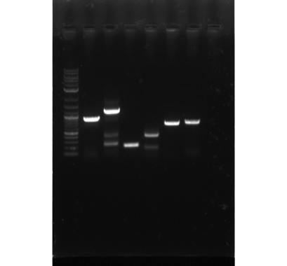 Photo of agarose gel showing cloned genes corresponding to the development of proprietary enzymes