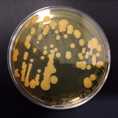 Petri dish with culture inside